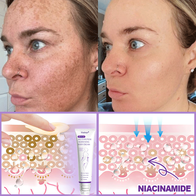 💎𝑽𝒊𝒕𝒂𝒍𝒊𝒔𝒚𝒔® 𝐏𝐃𝐑𝐍 𝐌𝐮𝐥𝐭𝐢-𝐏𝐞𝐩𝐭𝐢𝐝𝐞 𝐌𝐚𝐬𝐬𝐚𝐠𝐢𝐧𝐠 𝐁𝐨𝐝𝐲 𝐑𝐨𝐥𝐥𝐞𝐫 𝐂𝐫𝐞𝐚𝐦- 𝐀𝐧𝐭𝐢-𝐚𝐠𝐢𝐧𝐠, 𝐇𝐲𝐝𝐫𝐚𝐭𝐢𝐧𝐠, 𝐒𝐤𝐢𝐧 𝐅𝐢𝐫𝐦𝐢𝐧𝐠 & 𝐋𝐢𝐟𝐭𝐢𝐧𝐠, 𝐒𝐤𝐢𝐧 𝐑𝐞𝐩𝐚𝐢𝐫, 𝐄𝐯𝐞𝐧 𝐓𝐨𝐧𝐞, 𝐀𝐜𝐧𝐞 𝐚𝐧𝐝 𝐃𝐚𝐫𝐤 𝐒𝐩𝐨𝐭 𝐓𝐫𝐞𝐚𝐭𝐦𝐞𝐧𝐭, 𝐖𝐚𝐫𝐭 𝐚𝐧𝐝 𝐌𝐨𝐥𝐞 𝐑𝐞𝐦𝐨𝐯𝐚𝐥, 𝐚𝐧𝐝 𝐏𝐬𝐨𝐫𝐢𝐚𝐬𝐢𝐬 𝐑𝐞𝐥𝐢𝐞𝐟.