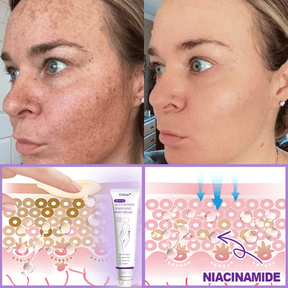 💎𝑽𝒊𝒕𝒂𝒍𝒊𝒔𝒚𝒔® 𝐏𝐃𝐑𝐍 𝐌𝐮𝐥𝐭𝐢-𝐏𝐞𝐩𝐭𝐢𝐝𝐞 𝐌𝐚𝐬𝐬𝐚𝐠𝐢𝐧𝐠 𝐁𝐨𝐝𝐲 𝐑𝐨𝐥𝐥𝐞𝐫 𝐂𝐫𝐞𝐚𝐦- 𝐀𝐧𝐭𝐢-𝐚𝐠𝐢𝐧𝐠, 𝐇𝐲𝐝𝐫𝐚𝐭𝐢𝐧𝐠, 𝐒𝐤𝐢𝐧 𝐅𝐢𝐫𝐦𝐢𝐧𝐠 & 𝐋𝐢𝐟𝐭𝐢𝐧𝐠, 𝐒𝐤𝐢𝐧 𝐑𝐞𝐩𝐚𝐢𝐫, 𝐄𝐯𝐞𝐧 𝐓𝐨𝐧𝐞, 𝐀𝐜𝐧𝐞 𝐚𝐧𝐝 𝐃𝐚𝐫𝐤 𝐒𝐩𝐨𝐭 𝐓𝐫𝐞𝐚𝐭𝐦𝐞𝐧𝐭, 𝐖𝐚𝐫𝐭 𝐚𝐧𝐝 𝐌𝐨𝐥𝐞 𝐑𝐞𝐦𝐨𝐯𝐚𝐥, 𝐚𝐧𝐝 𝐏𝐬𝐨𝐫𝐢𝐚𝐬𝐢𝐬 𝐑𝐞𝐥𝐢𝐞𝐟.